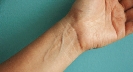 Photograph of a person's wrist with veins visible under the skin