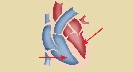 Illustration of a diagram of heart with red arrows pointing to the ventricles