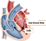 bad blood flow