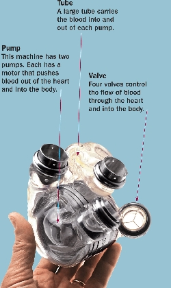 PumpThis machine has two pumps. Each has a motor that pushes blood out of the heart and into the body.