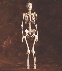 Photograph of the bones of a hanging skeleton